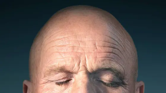 Face Reading: बनेंगे मालामाल या रहेंगे फटेहाल, बताते हैं माथे के ये निशान