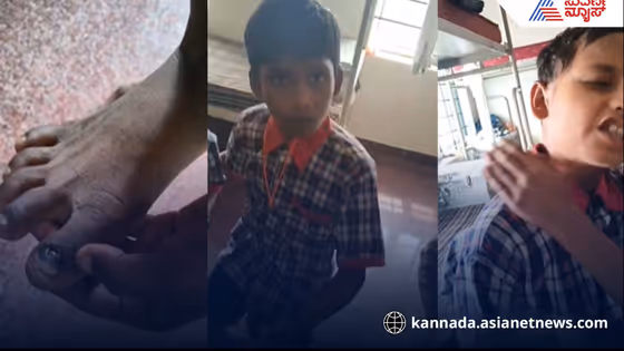 ಸಮಾಜ ಕಲ್ಯಾಣ ಸಚಿವರೇ ಇಲ್ಲಿ ನೋಡಿ, ಅಂಬೇಡ್ಕರ್ ವಸತಿ ಶಾಲೆಯಲ್ಲಿ ಮಕ್ಕಳಿಗೆ ನಿತ್ಯ ಟಾರ್ಚರ್!, ಪೆನ್ನು ಪುಸ್ತಕ ಕೇಳಿದ್ರೆ ಏಟು!