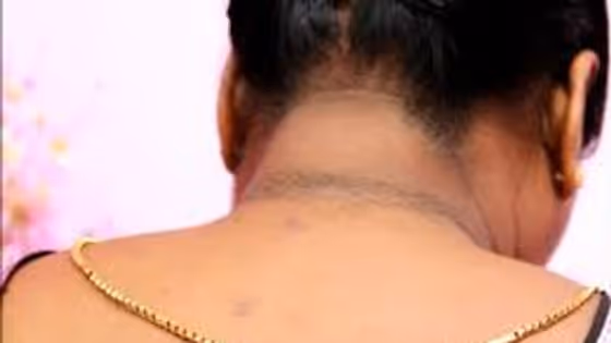 Neck Darkness : வீட்டுல தயிர் இருக்கா? கழுத்து கருமை வெறும் 2 வாரத்துல நீக்க சூப்பர் டிப்ஸ் இருக்கு; இனி அசிங்கபட வேணாம்