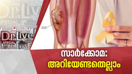 എല്ലുകളെയും പേശികളെയും ബാധിക്കുന്ന ക്യാന്സറിനെക്കുറിച്ച് അറിയാം