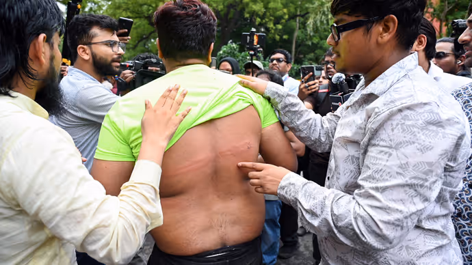 कहीं पीठ पर लाठियों के निशान तो कहीं बिखरी चप्पलें, जंतर-मंतर की 7 सबसे लेटेस्ट तस्वीरें