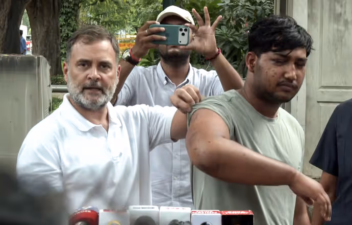टी-शर्ट उठा राहुल गांधी ने दिखाए साहिल के जख्म, 5 PHOTO में चोट के निशान देख कांप उठेगा कलेजा