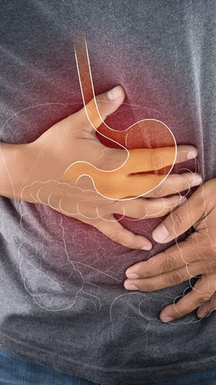 How To Control Acidity അസിഡിറ്റിയെ ചെറുക്കാൻ ഇതാ ഏഴ് മാർ ഗങ്ങൾ | Seven Easy Tips To Control ...