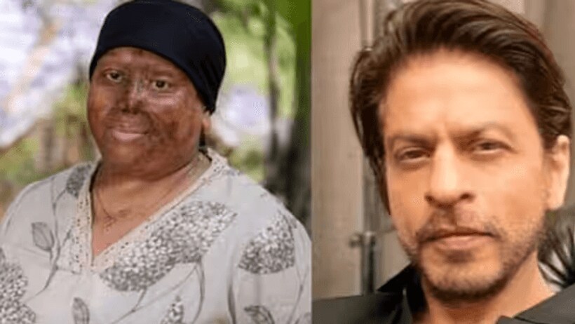 acid attack survivor seek help from shahrukh khan