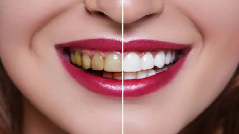 teeth 