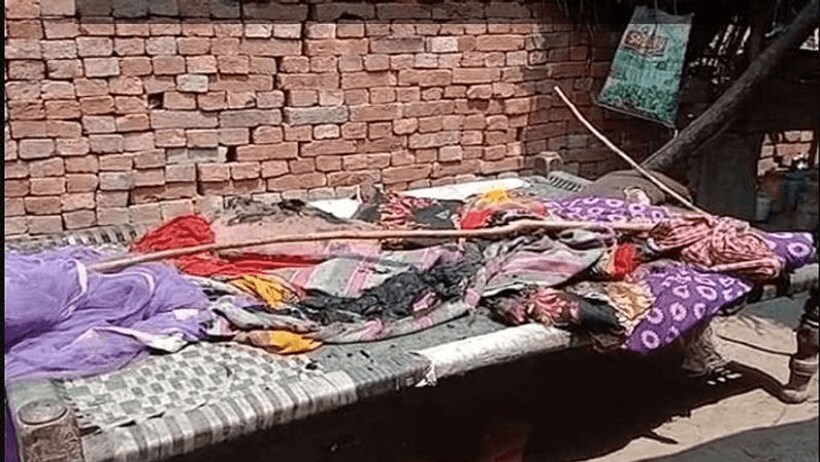 पीलीभीत: छेड़छाड़ के मुकदमे में समझौते का दबाव बना रहे आरोपी के परिजनों ने पीड़िता के माता पिता पर फेंका तेजाब