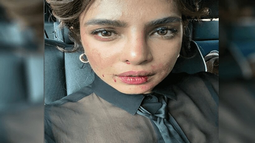 होठों पर खून आंखों में आंसू, प्रियंका चोपड़ा के साथ ये क्या हो गया?